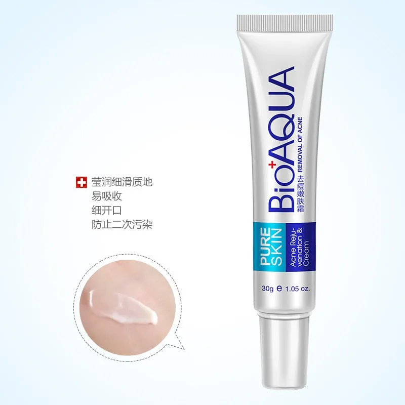 Acne Treatment Blackhead Removal Anti Acne Cream Oil Control